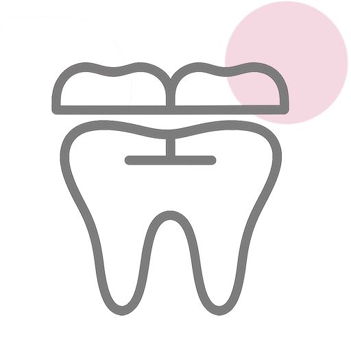 Dental Bridges