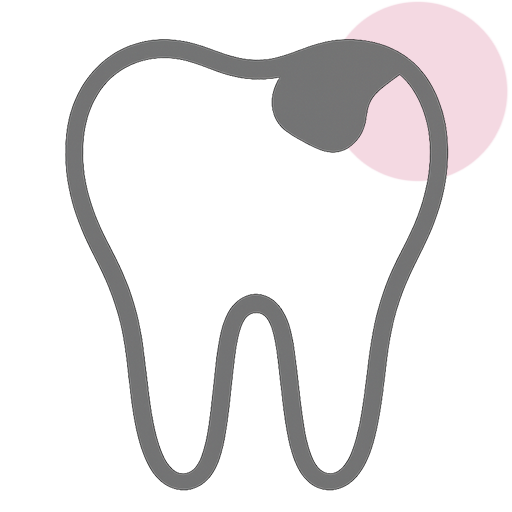 Dental Fillings