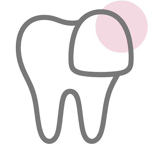 Veneers