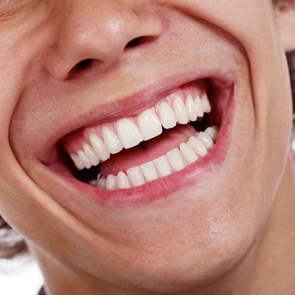 porcelain teeth